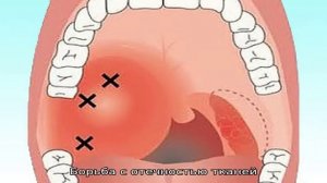 Что делать при красном горле у взрослого?
