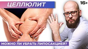 Можно ли убрать целлюлит с помощью липосакции? Что такое целлюлит? Апельсиновая корка