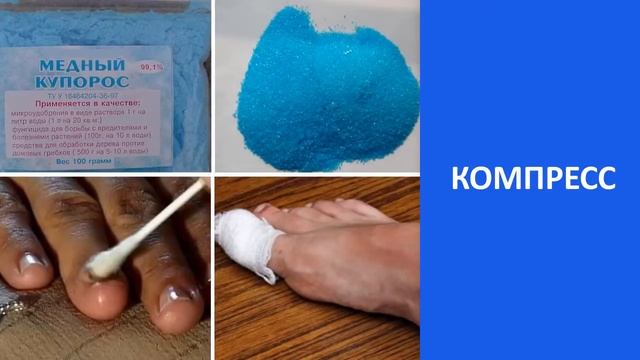 Если Замучал Грибок Ногтей То Смотрите смотреть онлайн