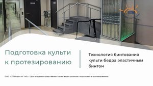 Бинтование культи бедра для формирования культи перед протезированием