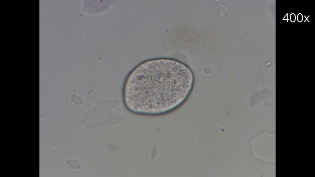 Мёд под Микроскопом. Увеличение 40х 400х. смотреть онлайн