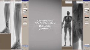 "Контур-Т" - Рентгенографический сканер досмотра человека в полный рост