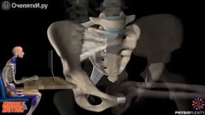 Почему болит спина. Поза ЗЮ!