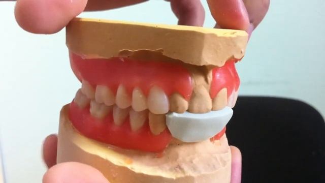 Постановка зубов для нейлоновых протез смотреть онлайн