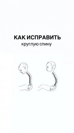 Как исправить круглую спину ?