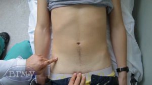 ГРЫЖИ l Проекция пахово - подвздошной области