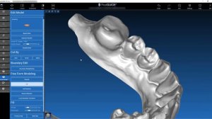 STL file processing and model set up with 3DIEMME RealGUIDE 5.0