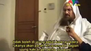 Хиджама. Как делать Хиджаму. Часть 6.