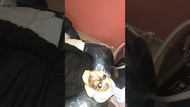 Карбоновый пилинг смотреть онлайн