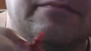 удаление зуба самостоятельно