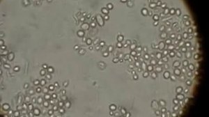 Дрожжи под микроскопом.  Дрожжи   грибы.