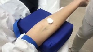 Подготовка к процедуре плазмолифтинга