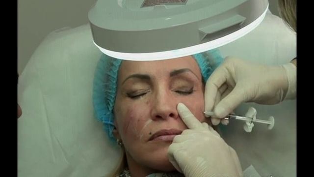 Техника работы канюлями смотреть онлайн