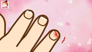 Trim your fingernails | Thomas's daily life | Cartoons | REDMON