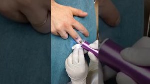 Портативный коагулятор