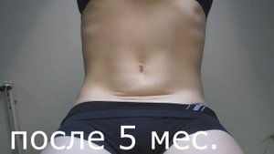 Вакуум живота. До и После. Результат за 5 месяцев.