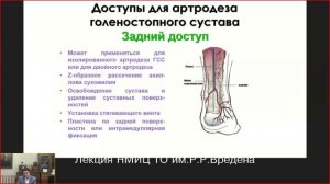 Ошибки и осложнения при лечении пациентов с посттравматическим артрозом голеностопного сустава.