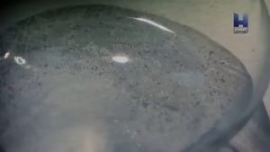 История возникновения лекарств - Обезболивающие