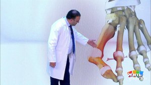 Клиническая картина. Шишка на пальце. Жить здорово! Фрагмент выпуска от 11.02.2020