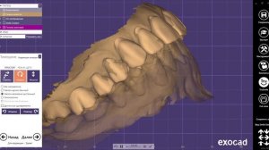 Создание виртуального MockUp в Exocad