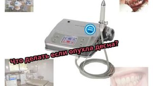 Что делать если опухла десна?