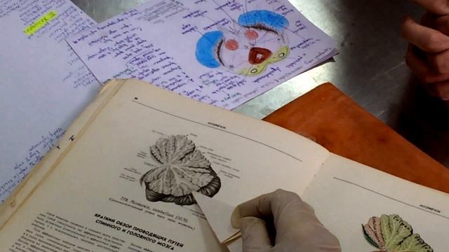 Ромбовидный мозг. Перешеек. Четвертый желудочек. смотреть онлайн