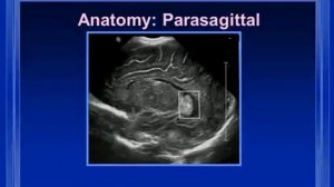 Нейросонография. Часть 2