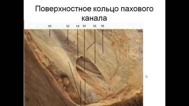 Топография передней брюшной стенки