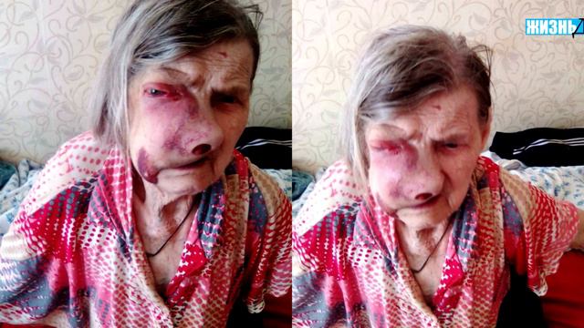 "И так скоро умрёт". В Перми врачи отказались от пенсионерки с тяжёлой болезнью.