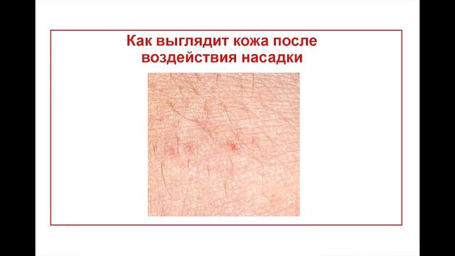 Вебинар JetPeel PRP 06 05 2020 смотреть онлайн