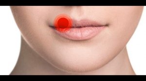 Откуда появляется герпес