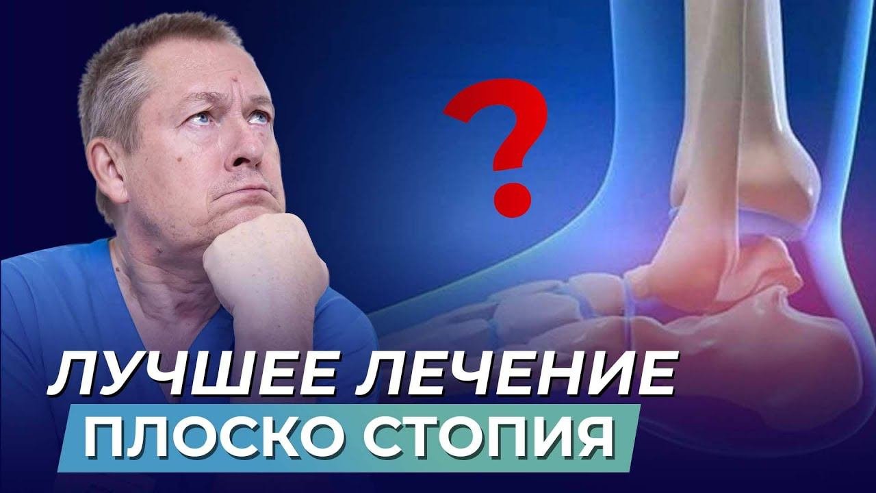 Что приводит к ПЛОСКОСТОПИЮ❓ЛЁГКИЙ СПОСОБ лечения искривления❗️