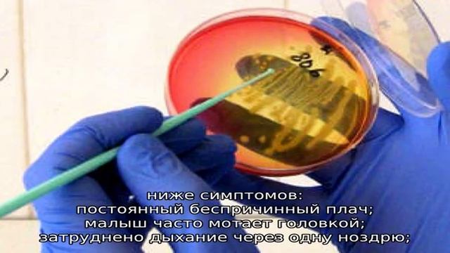 Этмоидит: симптомы и лечение у детей