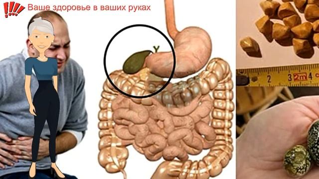 Как вывести желчные камни за 7 дней! смотреть онлайн