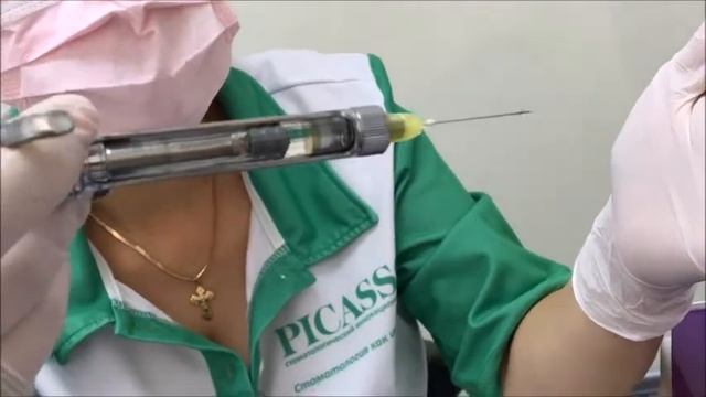 Aspiration test (аспирационная проба) при проведении местного обезболивания