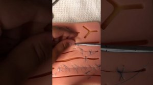 Непрерывный п образный шов