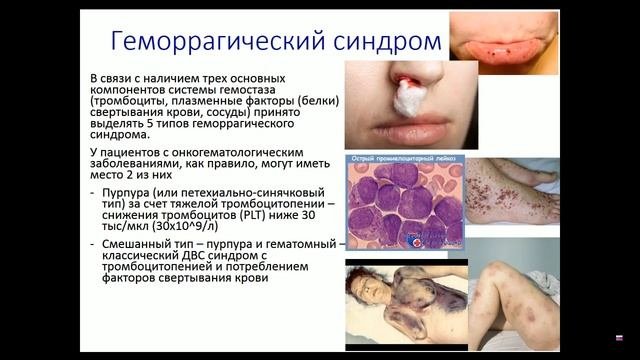 Онкогематология: введение, алгоритмы и методы диагностики