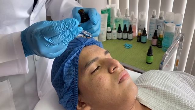 PROTOCOLO PEELING ANTI ACNE смотреть онлайн