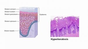USMLE RX - 8.Анатомия - 2.Дерматология - 5.Дерматологические МИКРОскопические Термины