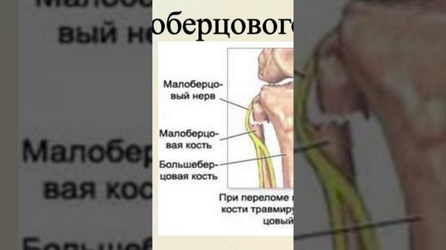 Как Вера победил О'Мэлли | [ Бойцовский путь ]