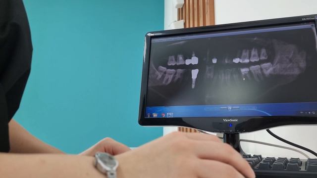 Что будет, если плохо чистить зубы? смотреть онлайн