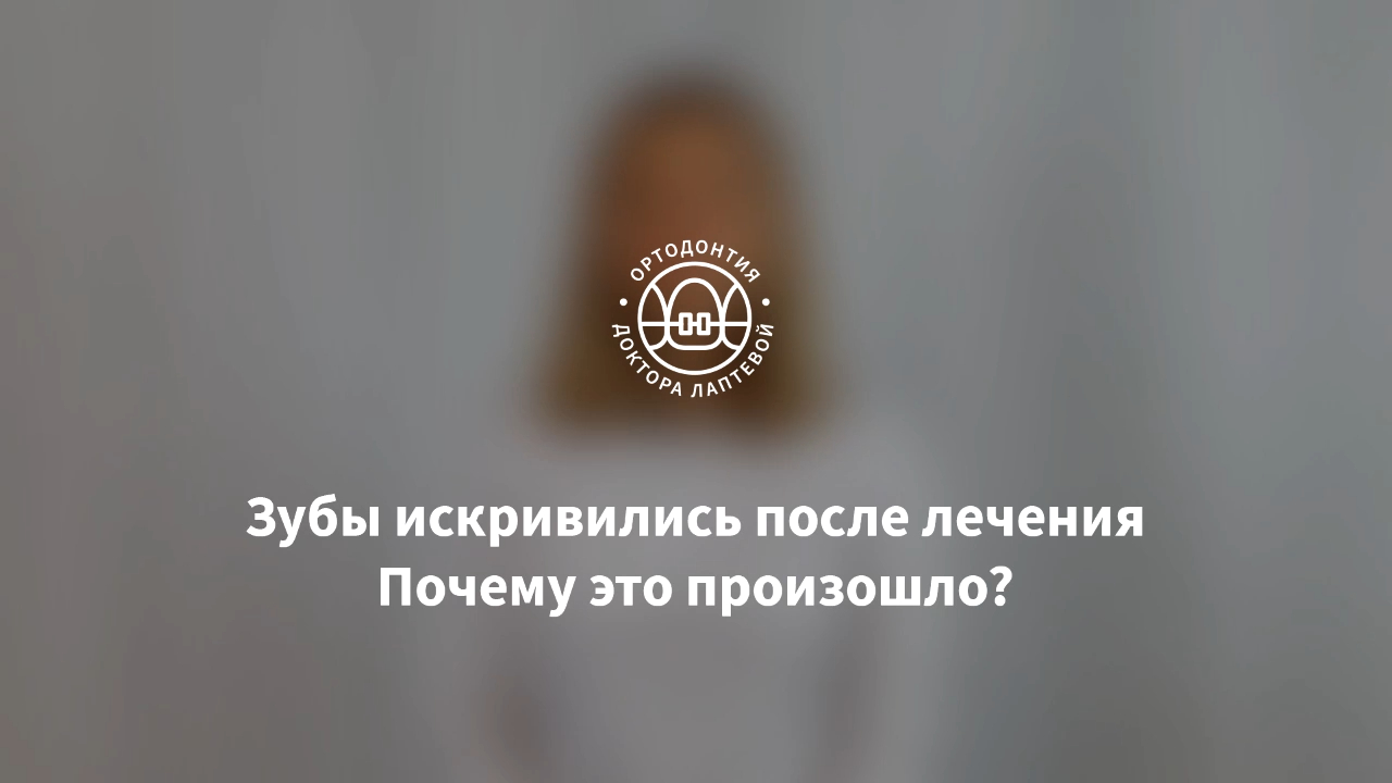 Зубы разъехались после брекетов? Ретейнеры, капы.