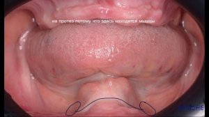 1.2 Подробный анализ беззубых челюстей.