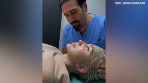 Подтяжка лица в 35лет!