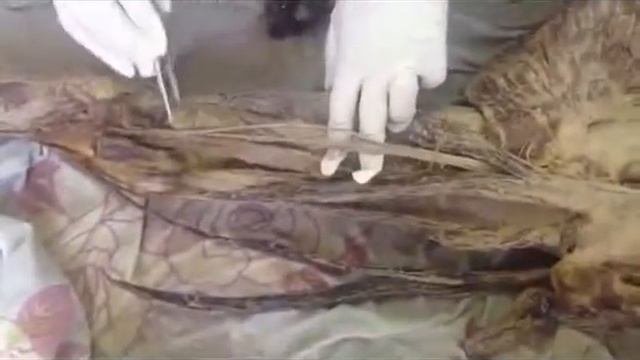Артерии и вены нижних конечностей