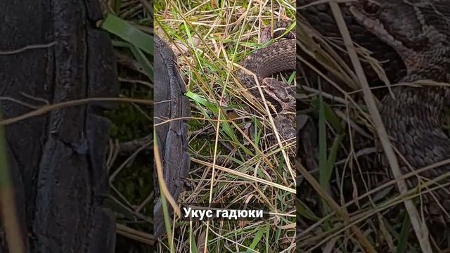 Укус гадюки. Увидишь такую - беги, если успеешь