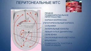 НАУЧНАЯ ШКОЛА "Подход к лучевой диагностике в онкогинекологии. Старые проблемы. Новые решения"