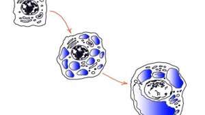 Гидропическая дистрофия