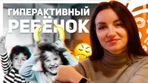 Гиперактивность у ребенка | Неусидчивый ребенок