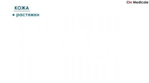 Синдром Марфана - механизм развития, причины, клинические проявления